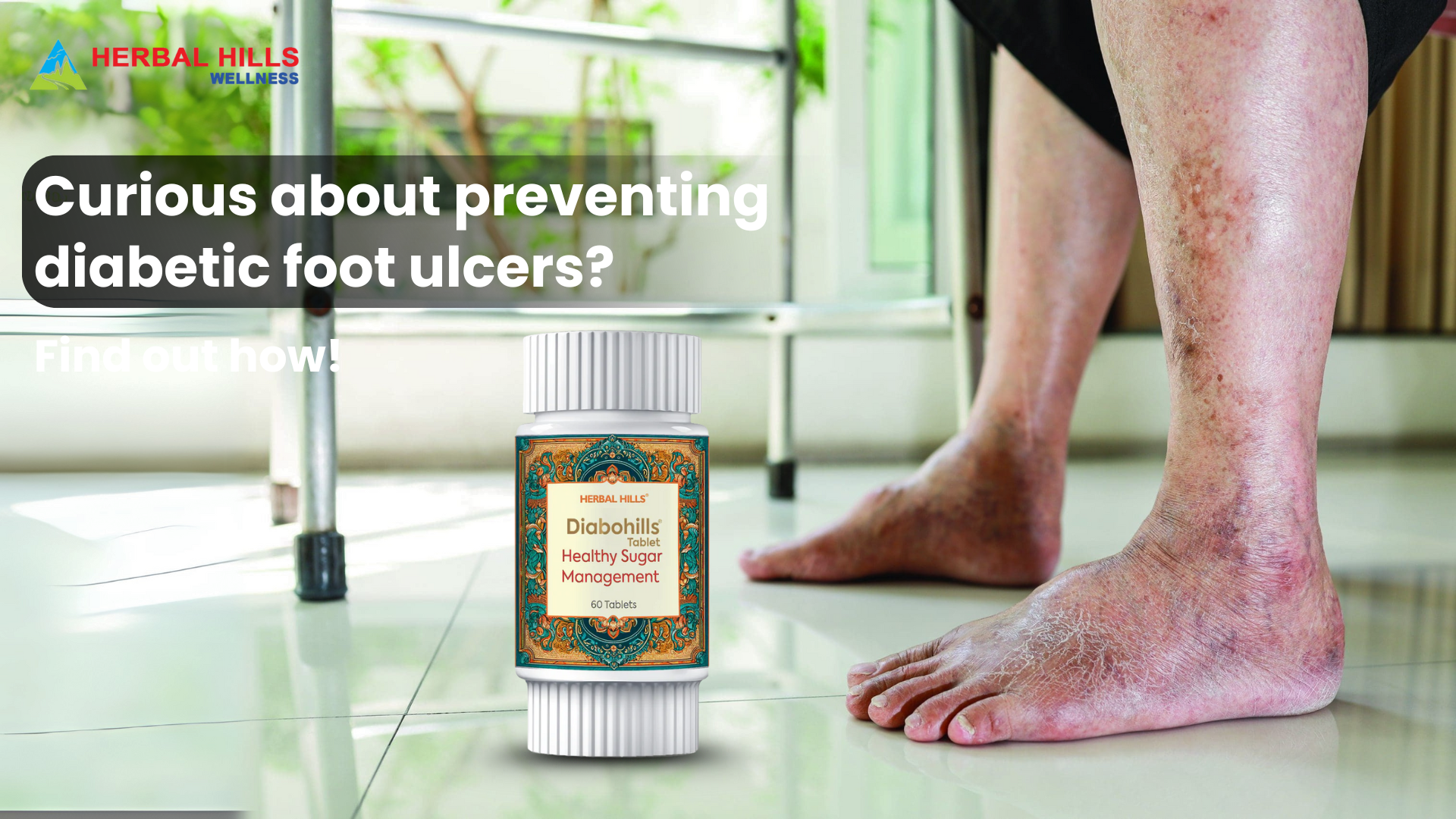 Keep Your Feet Healthy with Ayurvedic Medicine for Sugar Control: Prevent Diabetic Foot Ulcers Naturally